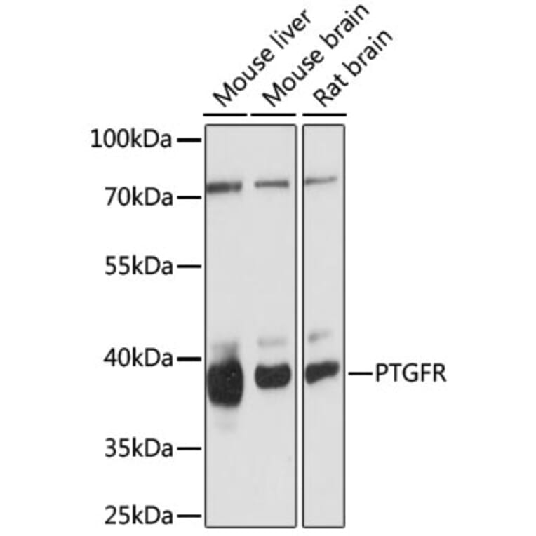 Western Blot - Anti-Prostaglandin F2 alpha Receptor/PTGFR Antibody (A89717) - Antibodies.com