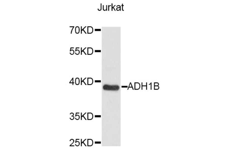 Western Blot - Anti-ADH1B Antibody (A14613) - Antibodies.com