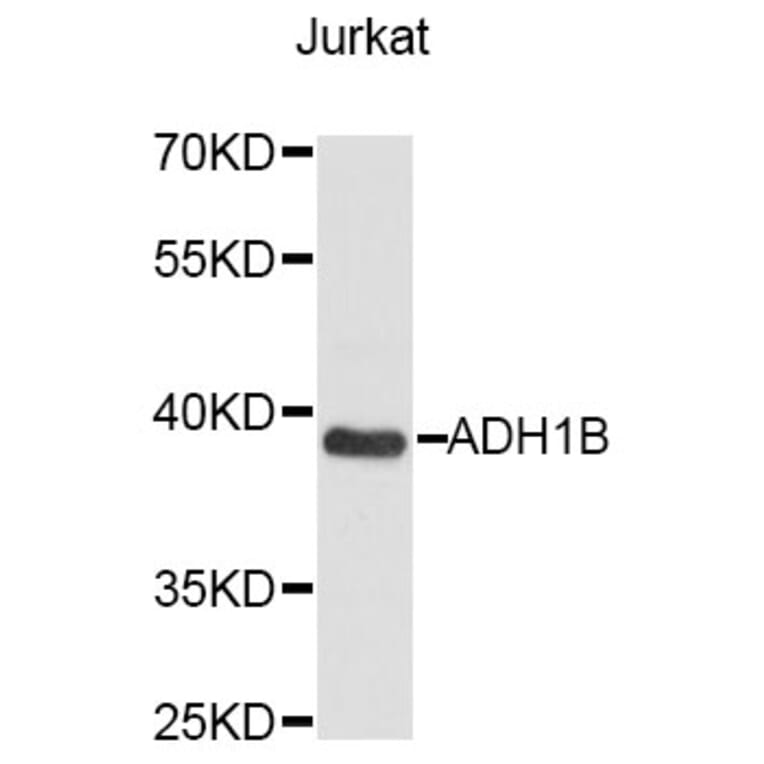 Western Blot - Anti-ADH1B Antibody (A14613) - Antibodies.com