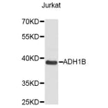 Western Blot - Anti-ADH1B Antibody (A14613) - Antibodies.com