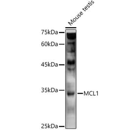 Western Blot - Anti-MCL1 Antibody (A89719) - Antibodies.com