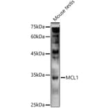 Western Blot - Anti-MCL1 Antibody (A89719) - Antibodies.com
