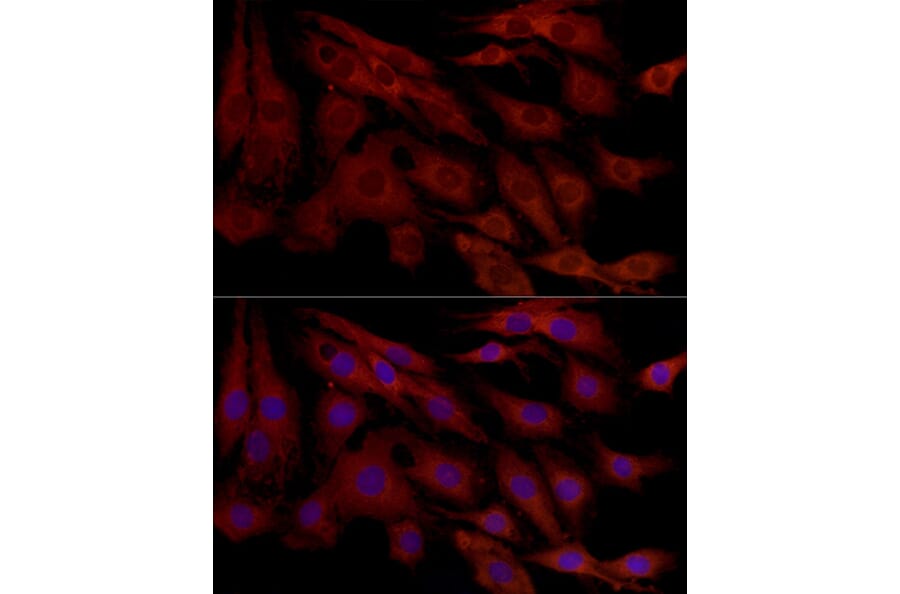 Immunofluorescence - Anti-MCL1 Antibody (A89719) - Antibodies.com
