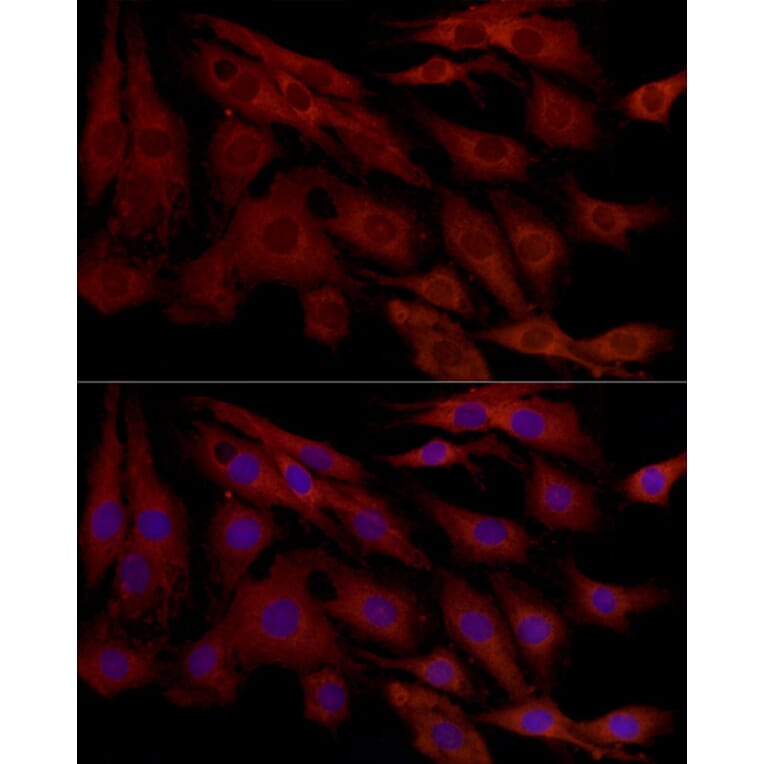 Immunofluorescence - Anti-MCL1 Antibody (A89719) - Antibodies.com