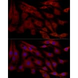 Immunofluorescence - Anti-MCL1 Antibody (A89719) - Antibodies.com