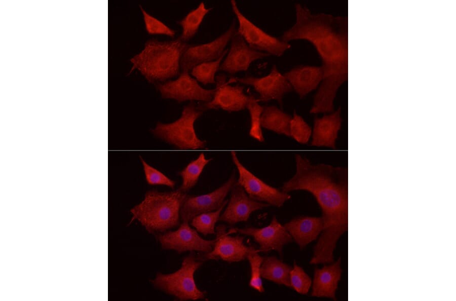 Immunofluorescence - Anti-MCL1 Antibody (A89719) - Antibodies.com