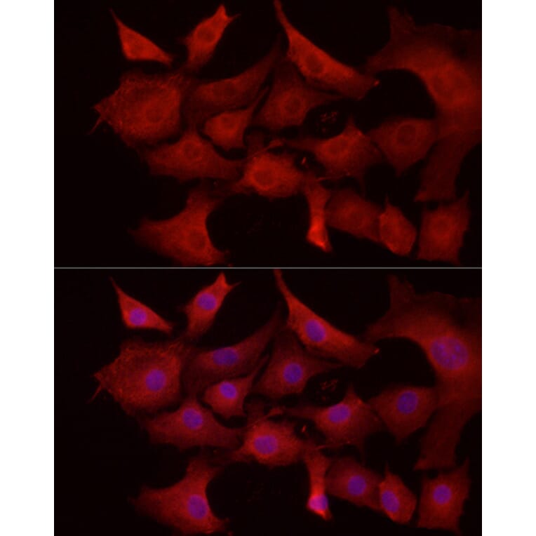 Immunofluorescence - Anti-MCL1 Antibody (A89719) - Antibodies.com