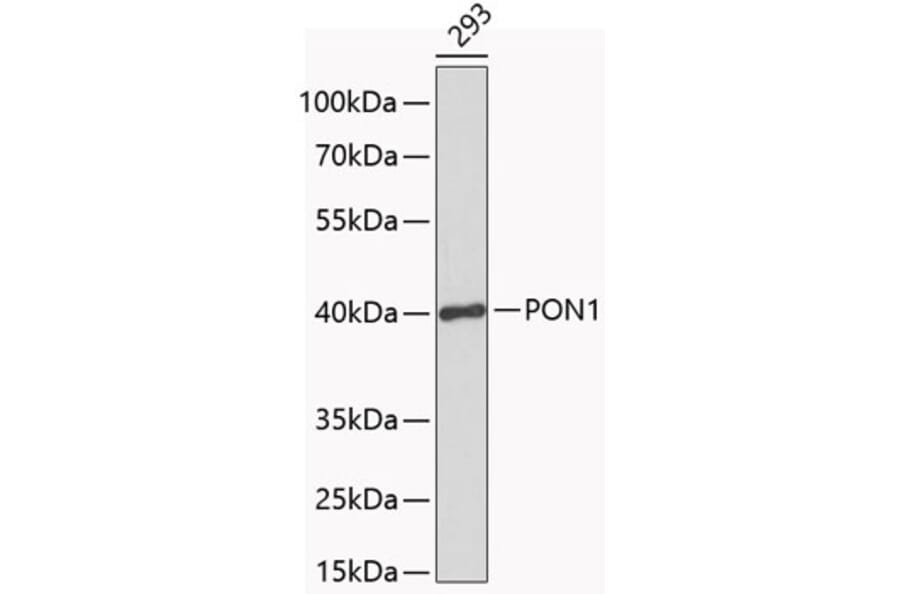 Western Blot - Anti-PON1 Antibody (A1320) - Antibodies.com