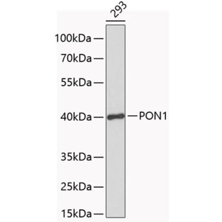 Western Blot - Anti-PON1 Antibody (A1320) - Antibodies.com