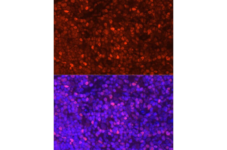 Immunofluorescence - Anti-LEF1 Antibody (A89721) - Antibodies.com