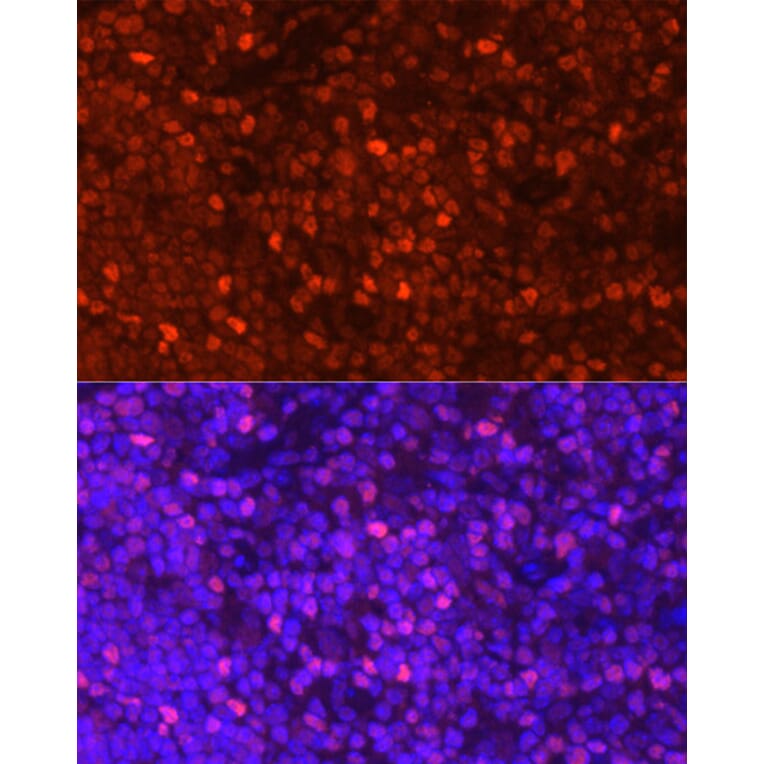 Immunofluorescence - Anti-LEF1 Antibody (A89721) - Antibodies.com