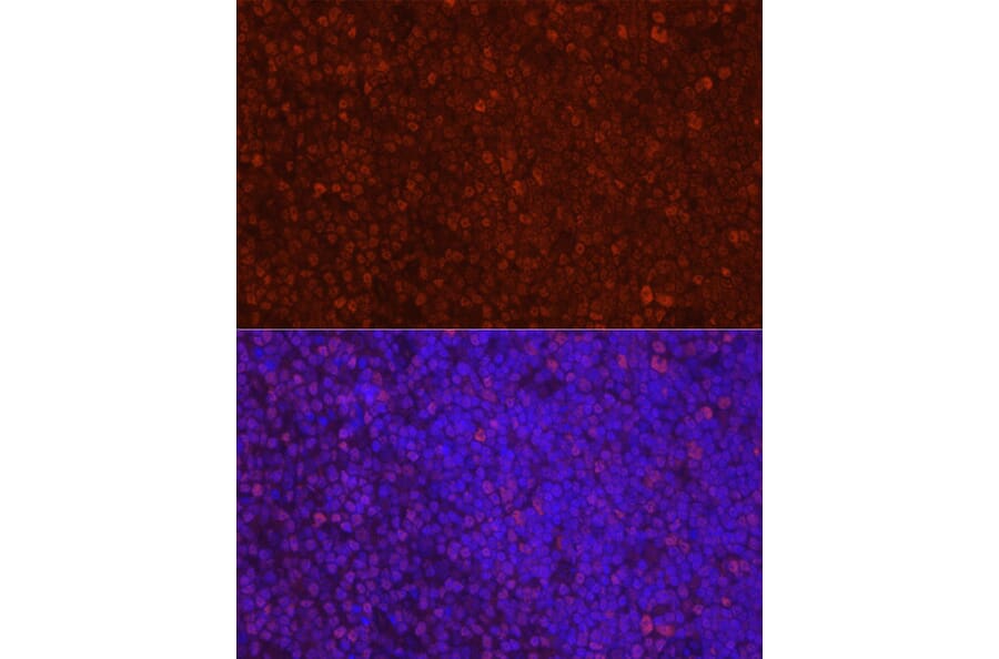 Immunofluorescence - Anti-LEF1 Antibody (A89721) - Antibodies.com