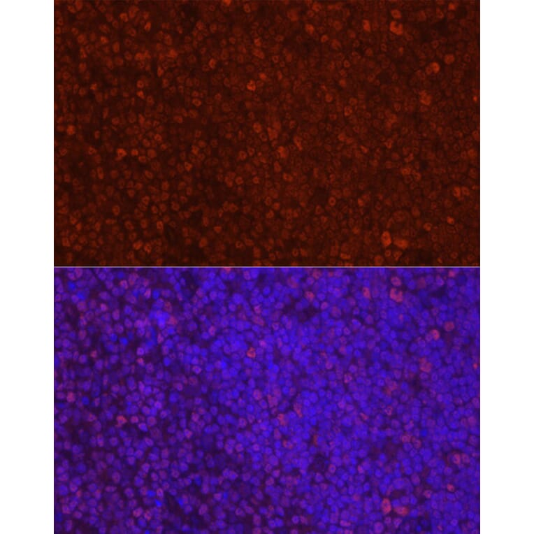 Immunofluorescence - Anti-LEF1 Antibody (A89721) - Antibodies.com