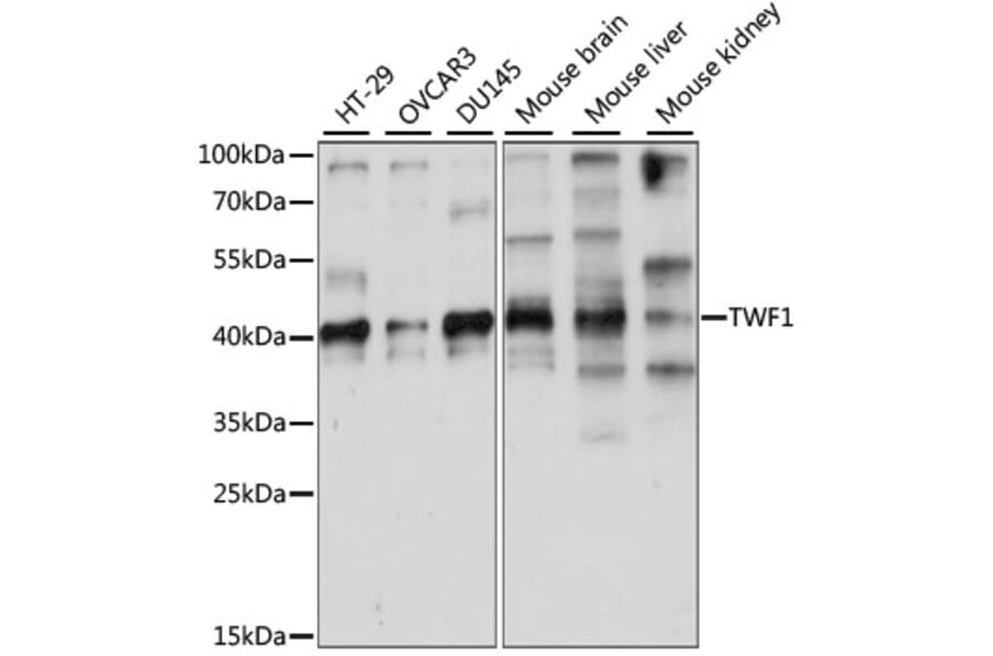Western Blot - Anti-TWF1/Twinfilin-1 Antibody (A89722) - Antibodies.com