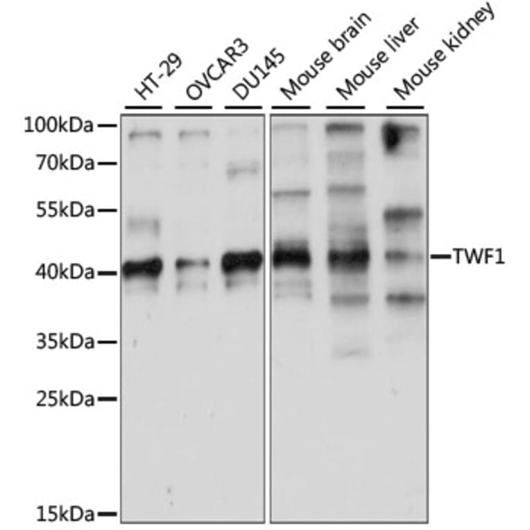 Western Blot - Anti-TWF1/Twinfilin-1 Antibody (A89722) - Antibodies.com