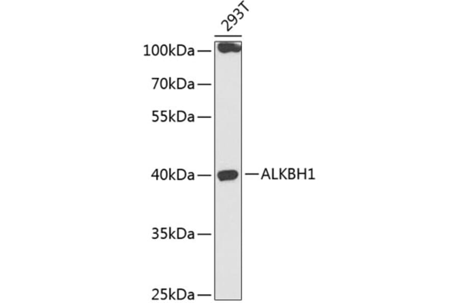 Western Blot - Anti-ALKBH1 Antibody (A89723) - Antibodies.com