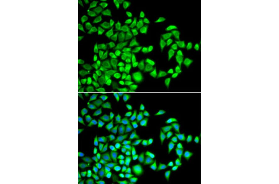 Immunofluorescence - Anti-ALKBH1 Antibody (A89723) - Antibodies.com