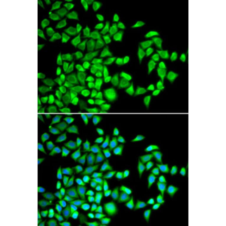 Immunofluorescence - Anti-ALKBH1 Antibody (A89723) - Antibodies.com