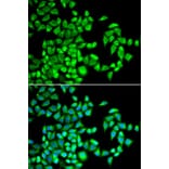 Immunofluorescence - Anti-ALKBH1 Antibody (A89723) - Antibodies.com