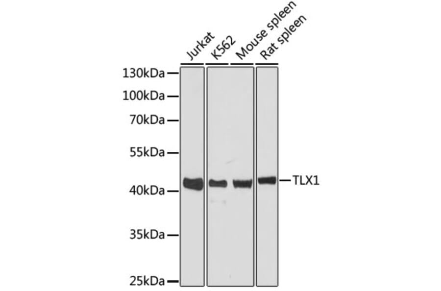 Western Blot - Anti-TLX1 Antibody (A89725) - Antibodies.com