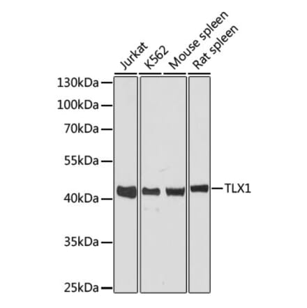 Western Blot - Anti-TLX1 Antibody (A89725) - Antibodies.com