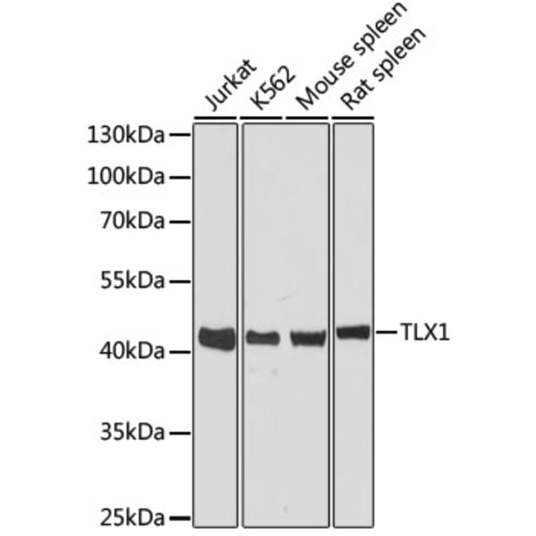 Western Blot - Anti-TLX1 Antibody (A89725) - Antibodies.com