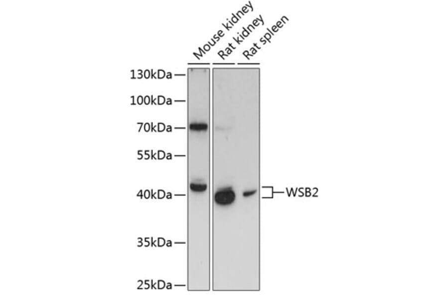 Western Blot - Anti-WSB2 Antibody (A89726) - Antibodies.com