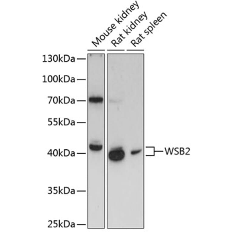 Western Blot - Anti-WSB2 Antibody (A89726) - Antibodies.com