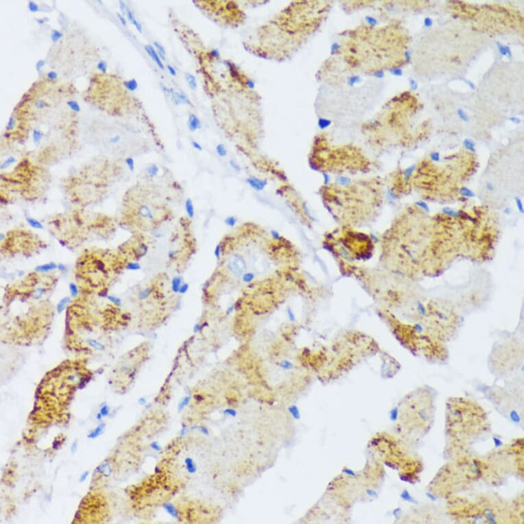 Immunohistochemistry - Anti-WSB2 Antibody (A89726) - Antibodies.com