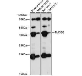 Western Blot - Anti-Tropomodulin 2 Antibody (A89727) - Antibodies.com