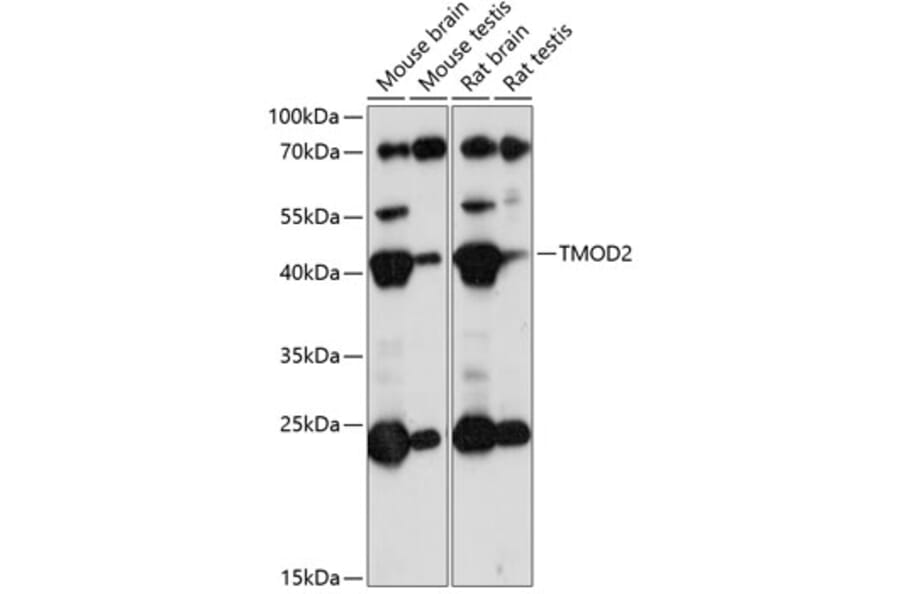 Western Blot - Anti-Tropomodulin 2 Antibody (A89727) - Antibodies.com