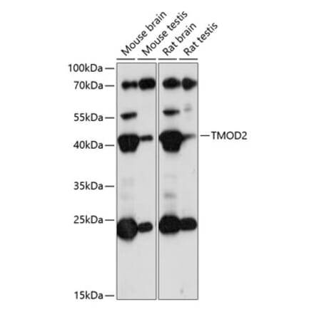 Western Blot - Anti-Tropomodulin 2 Antibody (A89727) - Antibodies.com