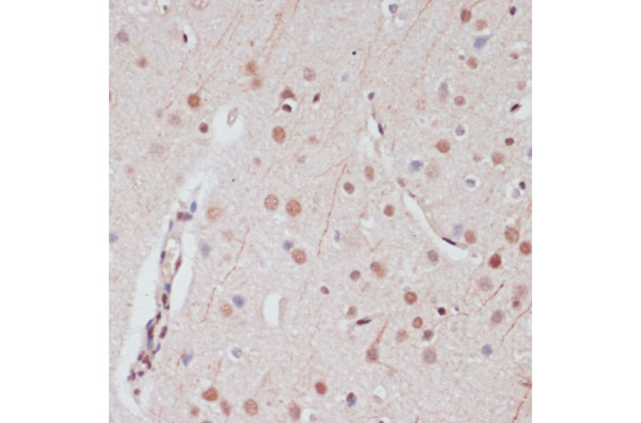 Immunohistochemistry - Anti-CREB Antibody (A89728) - Antibodies.com