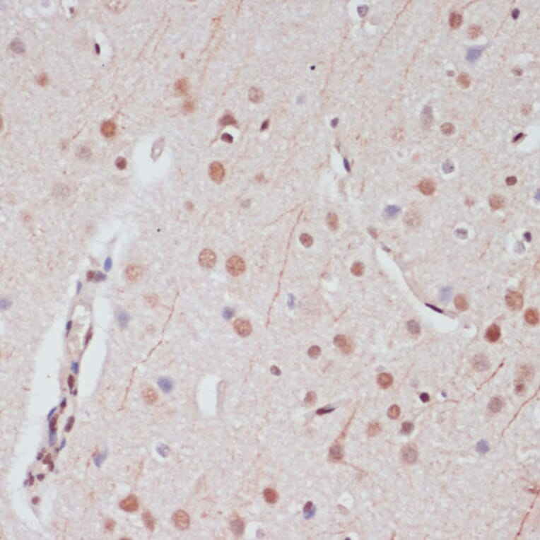 Immunohistochemistry - Anti-CREB Antibody (A89728) - Antibodies.com