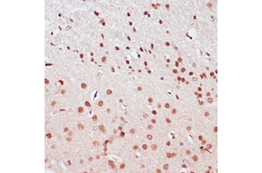 Immunohistochemistry - Anti-CREB Antibody (A89728) - Antibodies.com