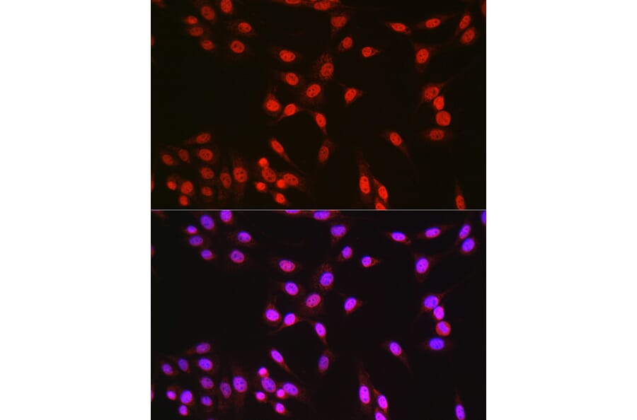 Immunofluorescence - Anti-CREB Antibody (A89728) - Antibodies.com