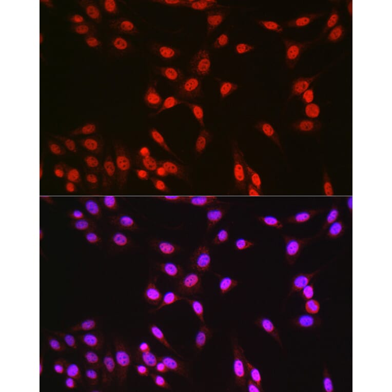 Immunofluorescence - Anti-CREB Antibody (A89728) - Antibodies.com