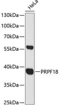 Western blot analysis of extracts of HeLa cells, using Anti-PRPF18 Antibody (A12817) at 1:3000 dilution.
Secondary antibody: Goat Anti-Rabbit IgG (H+L) (HRP) (AS014) at 1:10,000 dilution.
Lysates / proteins: 25µg per lane.
Blocking buffer: 3% non-fat dry milk in TBST.
Detection: ECL Basic Kit (RM00020).
Exposure time: 90s.