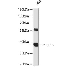 Western Blot - Anti-PRPF18 Antibody (A89729) - Antibodies.com