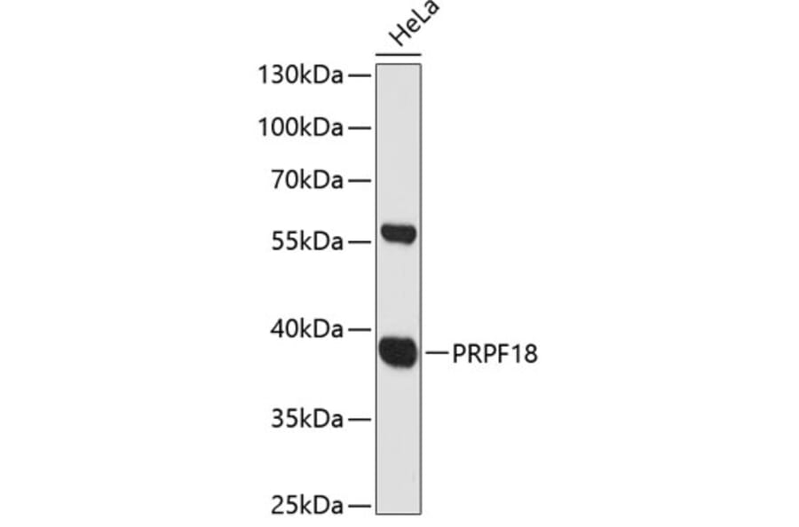 Western Blot - Anti-PRPF18 Antibody (A89729) - Antibodies.com