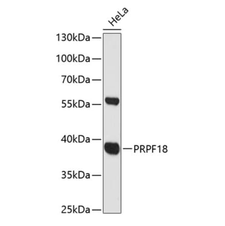 Western Blot - Anti-PRPF18 Antibody (A89729) - Antibodies.com