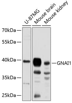 Western blot analysis of extracts of various cell lines, using Anti-GNAI1 Antibody (A8844) at 1:3000 dilution.
Secondary antibody: Goat Anti-Rabbit IgG (H+L) (HRP) (AS014) at 1:10,000 dilution.
Lysates / proteins: 25µg per lane.
Blocking buffer: 3% non-fat dry milk in TBST.
Detection: ECL Basic Kit (RM00020).
Exposure time: 90s.