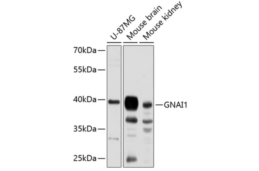 Western Blot - Anti-GNAI1 Antibody (A89730) - Antibodies.com