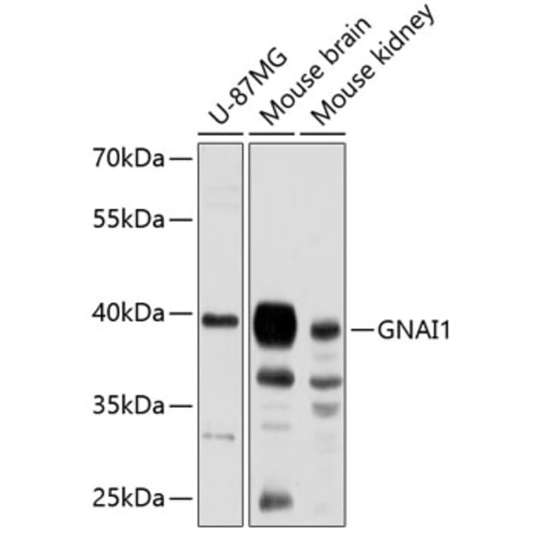 Western Blot - Anti-GNAI1 Antibody (A89730) - Antibodies.com