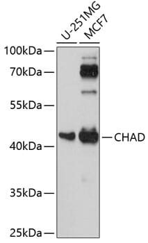Western blot analysis of extracts of various cell lines, using Anti-CHAD Antibody (A14985) at 1:1,000 dilution.
Secondary antibody: Goat Anti-Rabbit IgG (H+L) (HRP) (AS014) at 1:10,000 dilution.
Lysates / proteins: 25µg per lane.
Blocking buffer: 3% non-fat dry milk in TBST.
Detection: ECL Basic Kit (RM00020).
Exposure time: 90s.