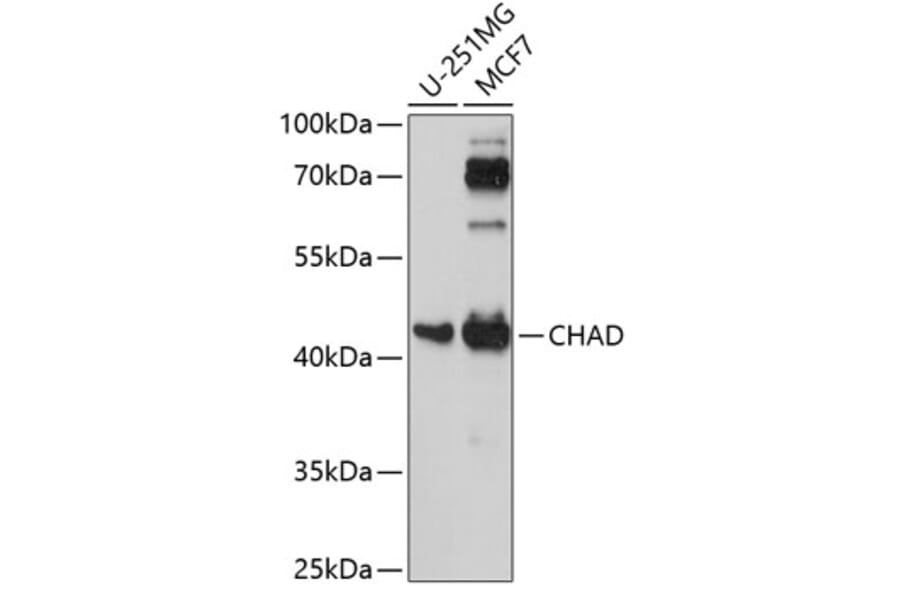 Western Blot - Anti-CHAD Antibody (A89731) - Antibodies.com
