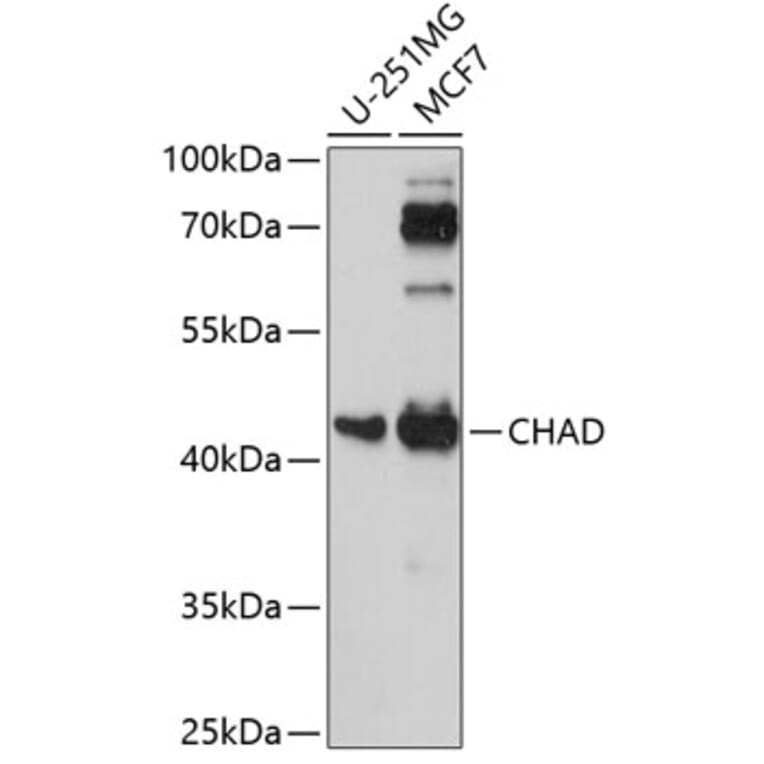 Western Blot - Anti-CHAD Antibody (A89731) - Antibodies.com