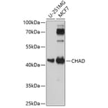 Western Blot - Anti-CHAD Antibody (A89731) - Antibodies.com