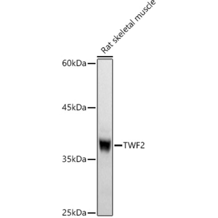 Western Blot - Anti-TWF2 Antibody (A89732) - Antibodies.com