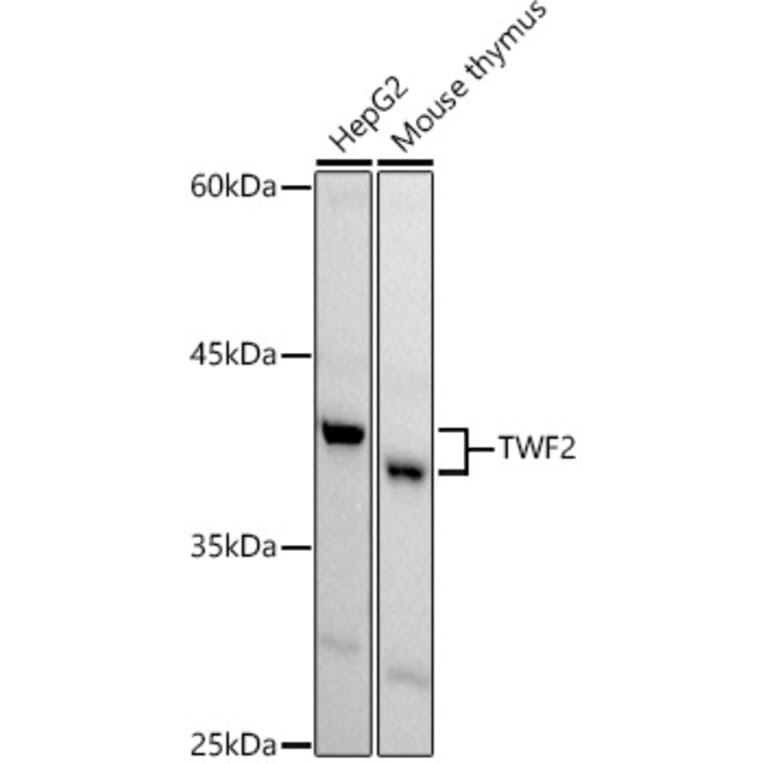Western Blot - Anti-TWF2 Antibody (A89732) - Antibodies.com
